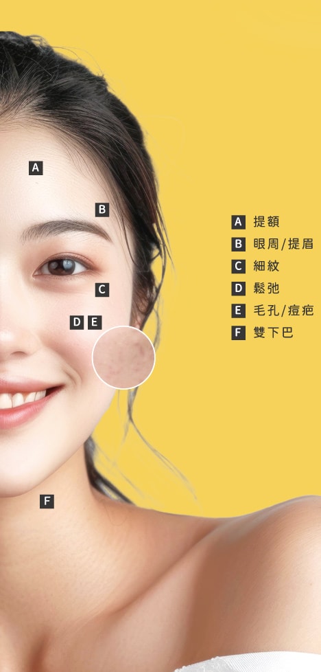 艾錡,艾錡醫美,醫美診所,高雄醫美,鼓山醫美,醫美診所,高雄醫美診所,減重門診,電波,音波,電音波拉提,onda,,艾錡診所 醫師 許峻達
