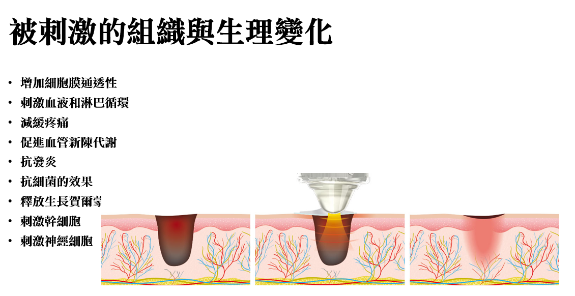 艾錡,艾錡醫美,醫美診所,高雄醫美,鼓山醫美,醫美診所,高雄醫美診所,減重門診,電波,音波,電音波拉提,onda,