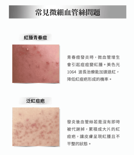 艾錡,艾錡醫美,醫美診所,高雄醫美,鼓山醫美,醫美診所,高雄醫美診所,減重門診,電波,音波,電音波拉提,onda,