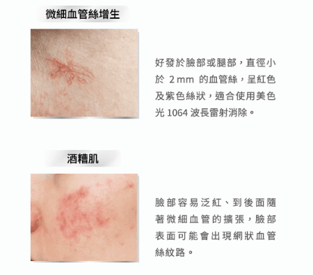 艾錡,艾錡醫美,醫美診所,高雄醫美,鼓山醫美,醫美診所,高雄醫美診所,減重門診,電波,音波,電音波拉提,onda,