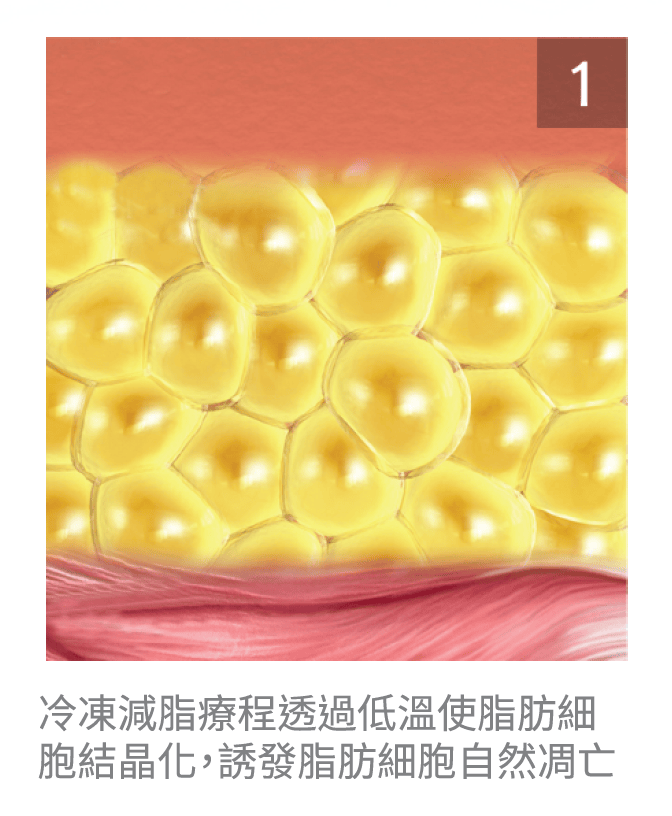 艾錡,艾錡醫美,醫美診所,高雄醫美,鼓山醫美,醫美診所,高雄醫美診所,減重門診,電波,音波,電音波拉提,onda,