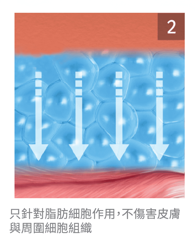 艾錡,艾錡醫美,醫美診所,高雄醫美,鼓山醫美,醫美診所,高雄醫美診所,減重門診,電波,音波,電音波拉提,onda,