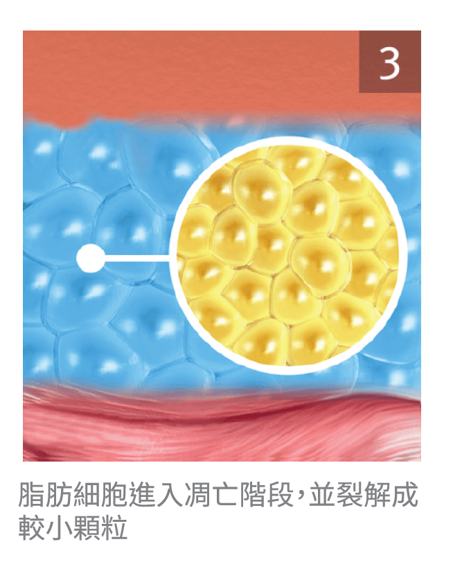 艾錡,艾錡醫美,醫美診所,高雄醫美,鼓山醫美,醫美診所,高雄醫美診所,減重門診,電波,音波,電音波拉提,onda,