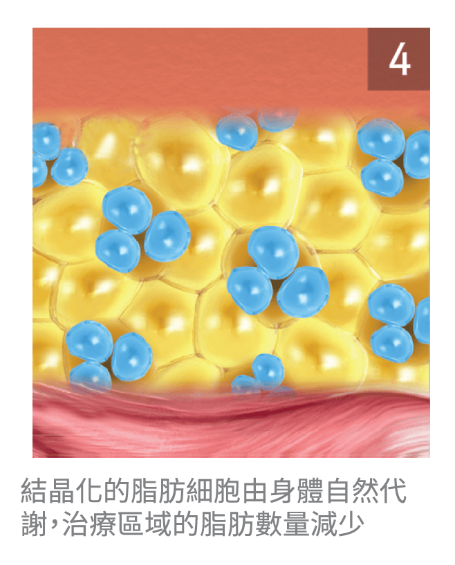 艾錡,艾錡醫美,醫美診所,高雄醫美,鼓山醫美,醫美診所,高雄醫美診所,減重門診,電波,音波,電音波拉提,onda,