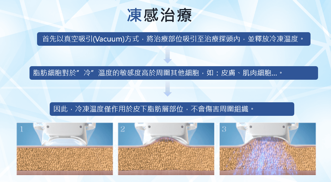 艾錡,艾錡醫美,醫美診所,高雄醫美,鼓山醫美,醫美診所,高雄醫美診所,減重門診,電波,音波,電音波拉提,onda,