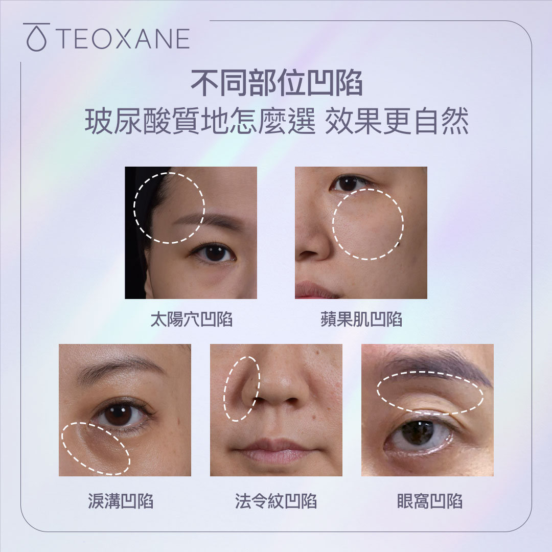 艾錡,艾錡醫美,醫美診所,高雄醫美,鼓山醫美,醫美診所,高雄醫美診所,減重門診,電波,音波,電音波拉提,onda,