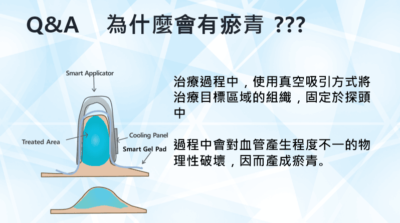 艾錡,艾錡醫美,醫美診所,高雄醫美,鼓山醫美,醫美診所,高雄醫美診所,減重門診,電波,音波,電音波拉提,onda,