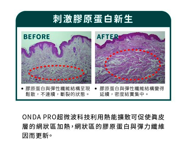 Onda Pro 超微波 - 第2張圖 Onda Pro 超微波