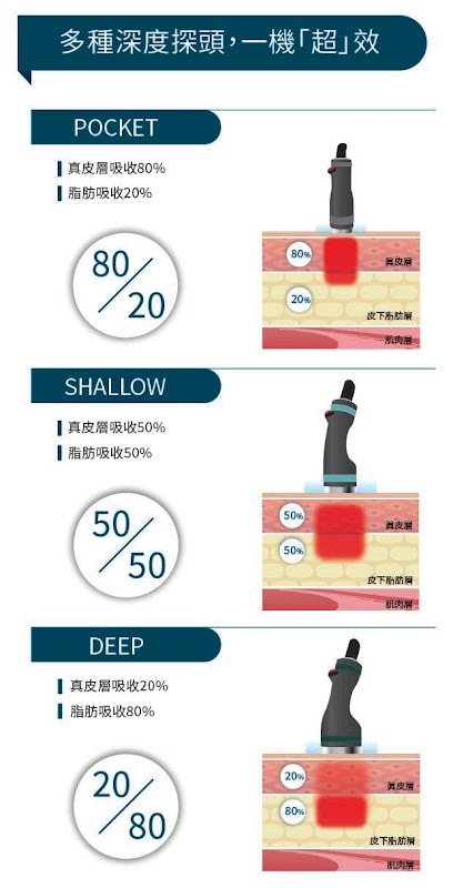 Onda Pro 超微波 - 第3張圖 Onda Pro 超微波