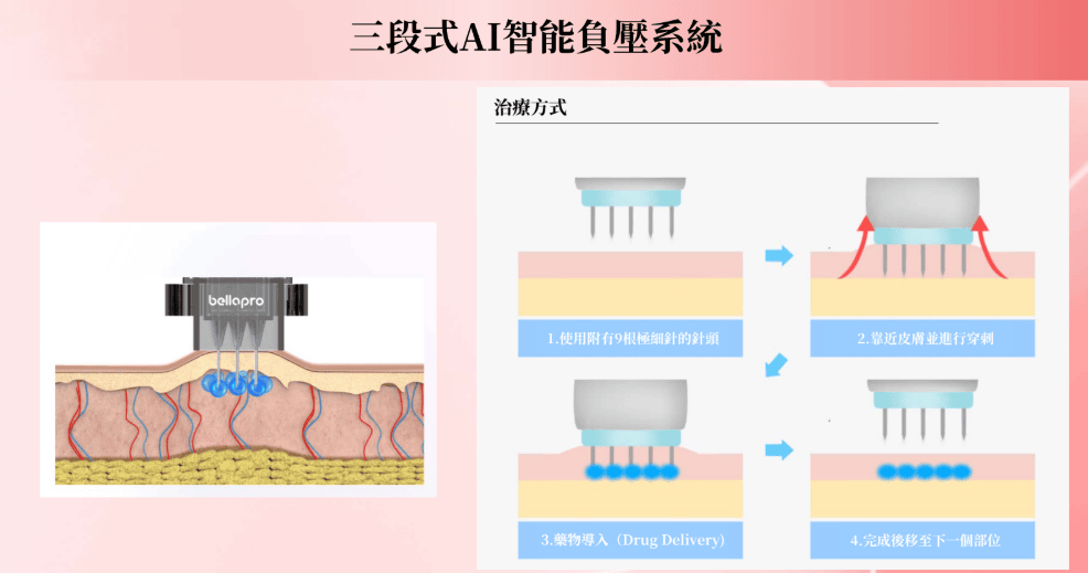 艾錡,艾錡醫美,醫美診所,高雄醫美,鼓山醫美,醫美診所,高雄醫美診所,減重門診,電波,音波,電音波拉提,onda,
