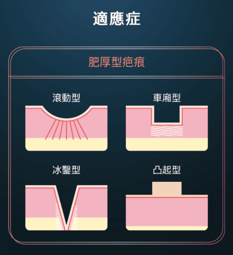 艾錡,艾錡醫美,醫美診所,高雄醫美,鼓山醫美,醫美診所,高雄醫美診所,減重門診,電波,音波,電音波拉提,onda,