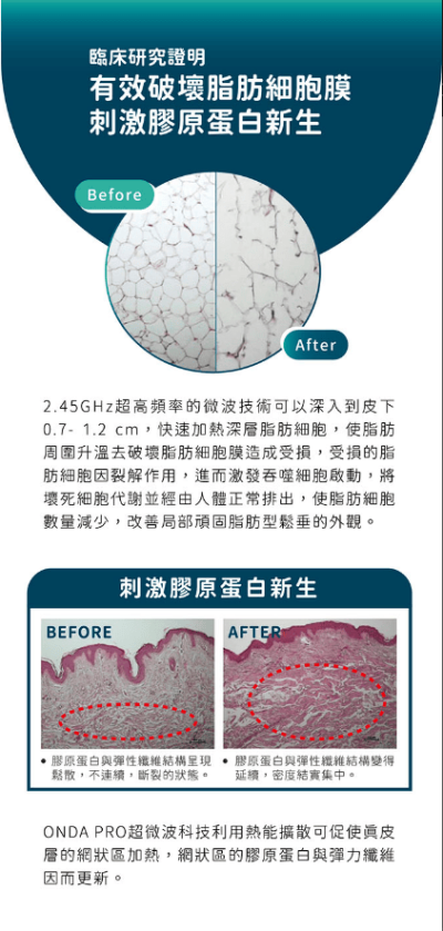 艾錡,艾錡醫美,醫美診所,高雄醫美,鼓山醫美,醫美診所,高雄醫美診所,減重門診,電波,音波,電音波拉提,onda,艾錡診所 醫師 許峻達